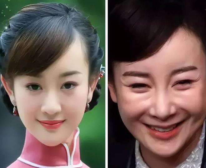 人长出老年斑有人家破人亡毁了脸球王会体育6位过气明星现状：有(图4)
